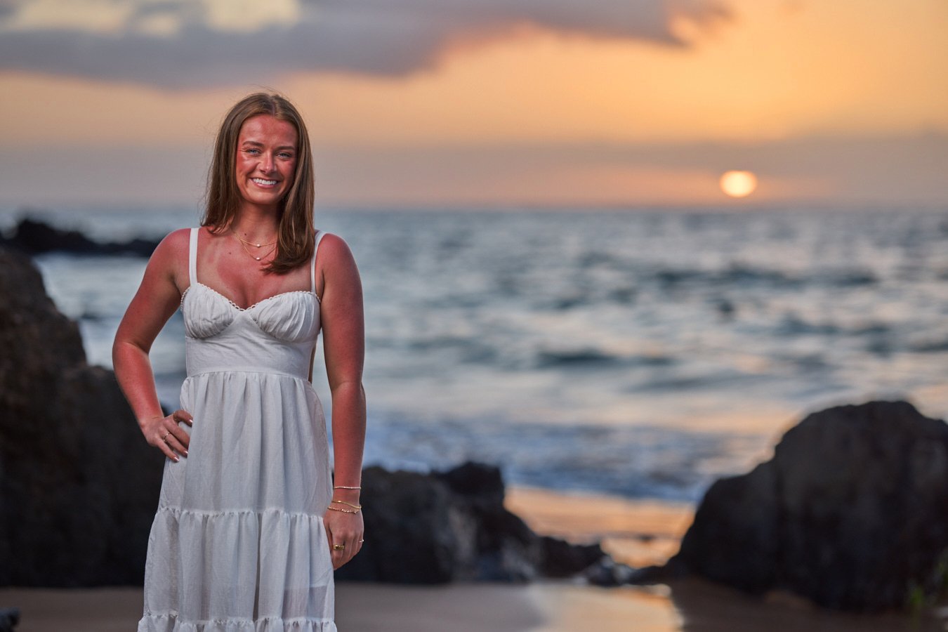 Visible facial and shoulder sunburn before a sunset portrait session in Wailea, Maui